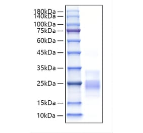 SDS-PAGE - Recombinant Mouse CD153 Protein (N-terminal His Tag) (A331920) - Antibodies.com