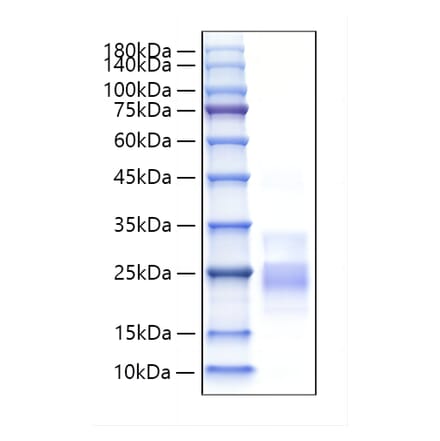 SDS-PAGE - Recombinant Mouse CD153 Protein (N-terminal His Tag) (A331920) - Antibodies.com