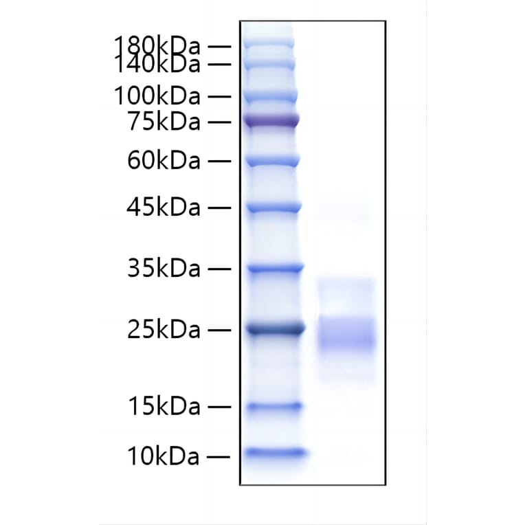 SDS-PAGE - Recombinant Mouse CD153 Protein (N-terminal His Tag) (A331920) - Antibodies.com