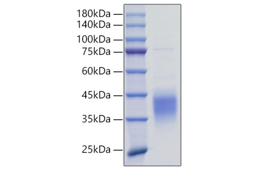 SDS-PAGE - Recombinant Mouse TNFRSF9 Protein (N-terminal His Tag) (A331921) - Antibodies.com