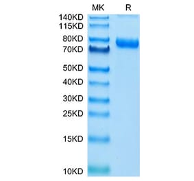 Tris-Bis PAGE - Recombinant Cynomolgus macaque CD71 Protein (N-terminal His Tag) (A331922) - Antibodies.com