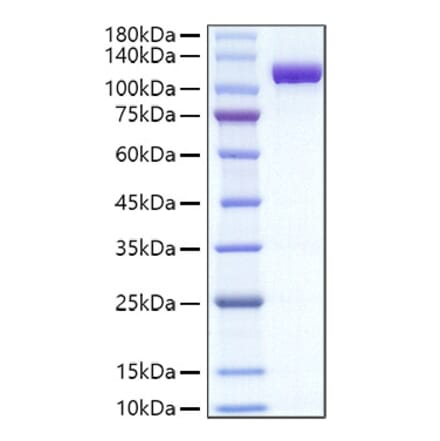 SDS-PAGE - Recombinant Mouse Transferrin Protein (C-terminal Human Fc Tag) (A331923) - Antibodies.com