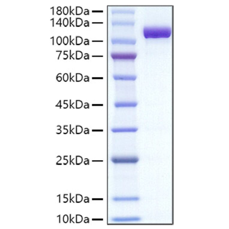 SDS-PAGE - Recombinant Mouse Transferrin Protein (C-terminal Human Fc Tag) (A331923) - Antibodies.com