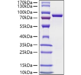 SDS-PAGE - Recombinant Mouse Transferrin Protein (C-terminal His Tag) (A331924) - Antibodies.com