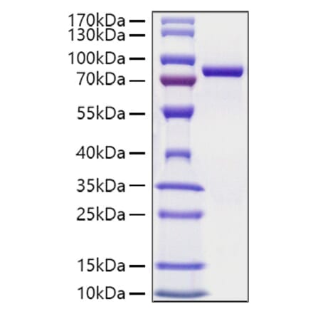 SDS-PAGE - Recombinant Mouse Transferrin Protein (C-terminal His Tag) (A331924) - Antibodies.com