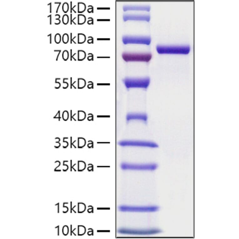 SDS-PAGE - Recombinant Mouse Transferrin Protein (C-terminal His Tag) (A331924) - Antibodies.com