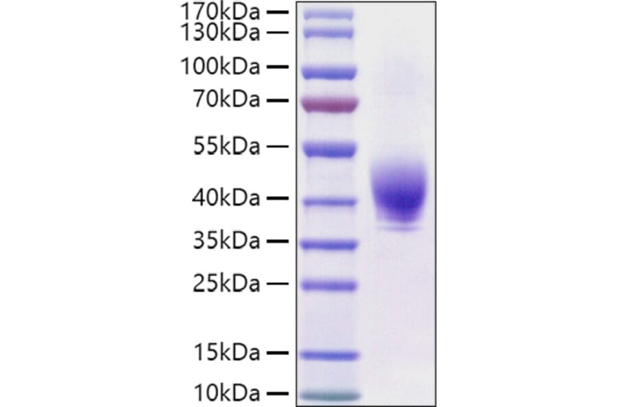 SDS-PAGE - Recombinant Rat TROP2 Protein (C-terminal His Tag) (A331925) - Antibodies.com