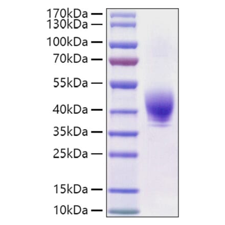 SDS-PAGE - Recombinant Rat TROP2 Protein (C-terminal His Tag) (A331925) - Antibodies.com