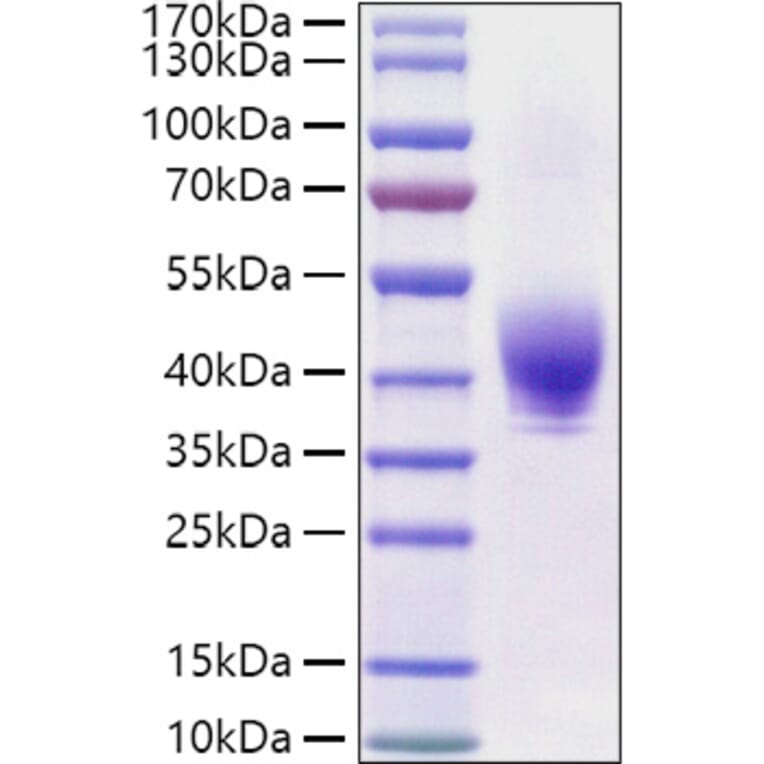 SDS-PAGE - Recombinant Rat TROP2 Protein (C-terminal His Tag) (A331925) - Antibodies.com