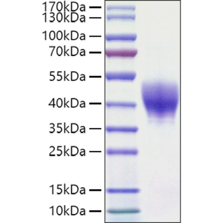 SDS-PAGE - Recombinant Mouse TROP2 Protein (C-terminal His Tag) (A331926) - Antibodies.com