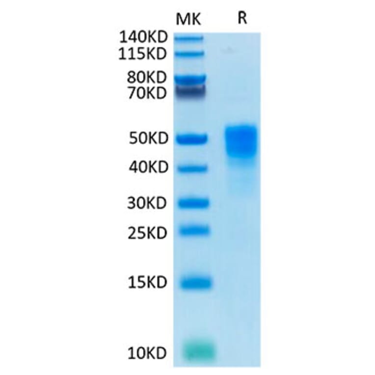 Tris-Bis PAGE - Recombinant Cynomolgus macaque TROP2 Protein (C-terminal His Tag) (A331927) - Antibodies.com