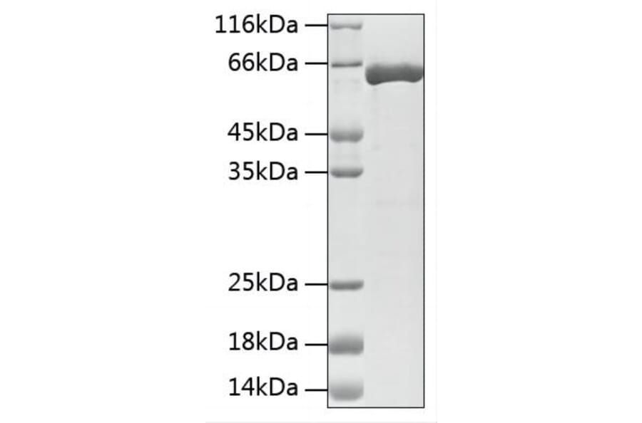 SDS-PAGE - Recombinant Mouse TH Protein (N-terminal His Tag) (A331928) - Antibodies.com