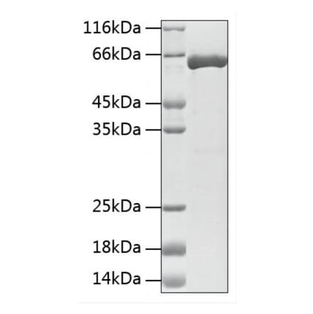 SDS-PAGE - Recombinant Mouse TH Protein (N-terminal His Tag) (A331928) - Antibodies.com