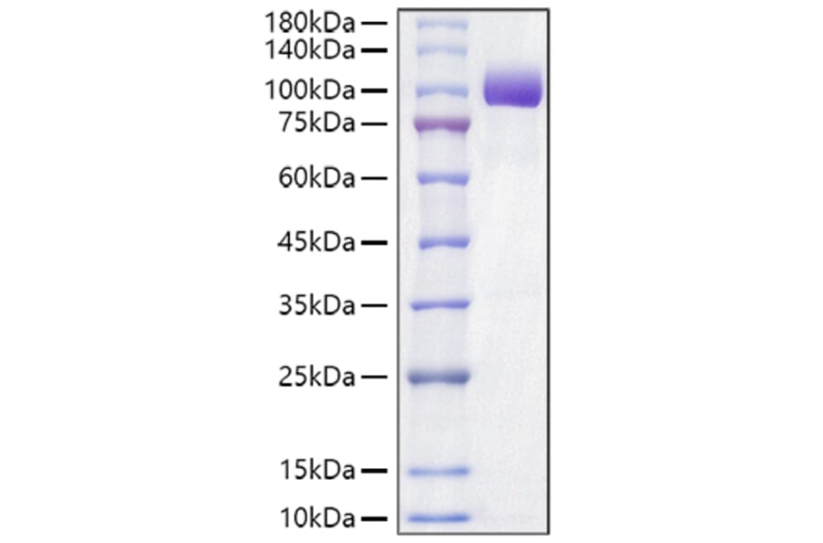 SDS-PAGE - Recombinant Mouse Axl Protein (C-terminal Human Fc Tag) (A331929) - Antibodies.com