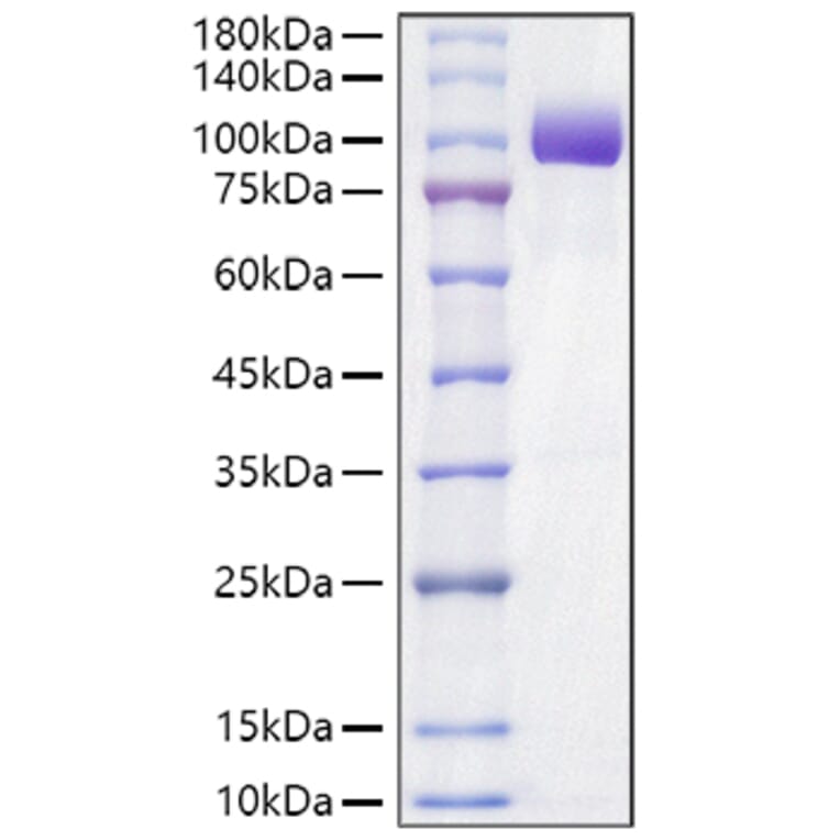 SDS-PAGE - Recombinant Mouse Axl Protein (C-terminal Human Fc Tag) (A331929) - Antibodies.com