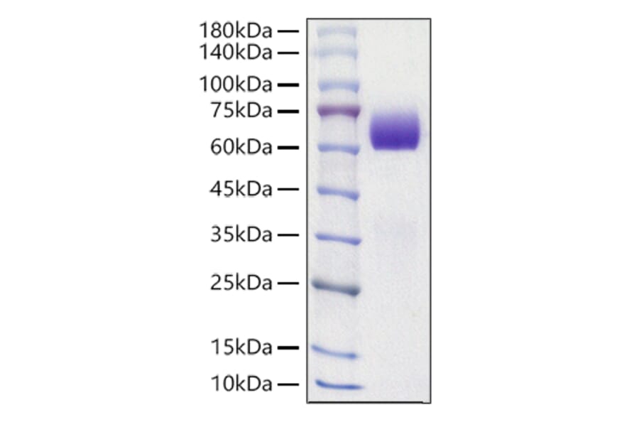 SDS-PAGE - Recombinant Mouse Axl Protein (C-terminal His Tag) (A331930) - Antibodies.com