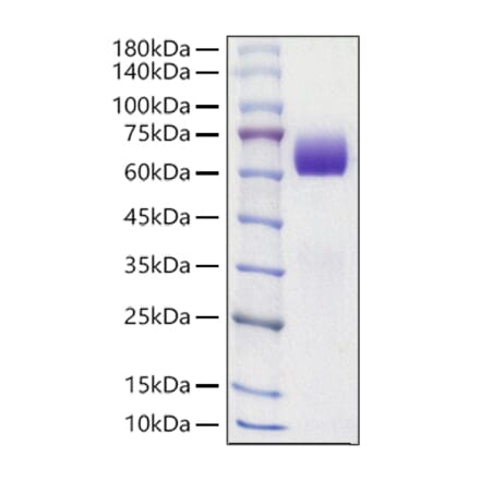 SDS-PAGE - Recombinant Mouse Axl Protein (C-terminal His Tag) (A331930) - Antibodies.com