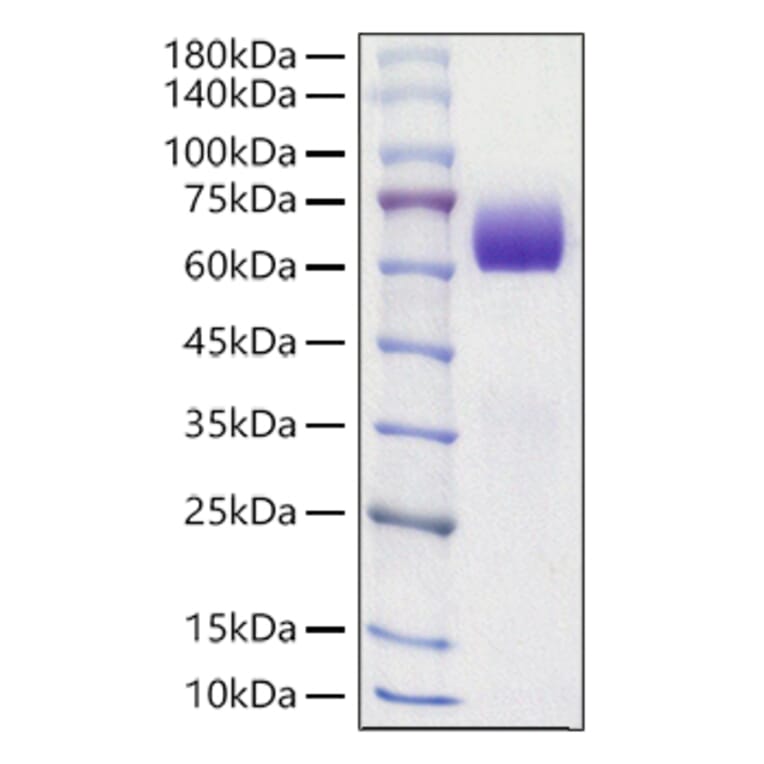 SDS-PAGE - Recombinant Mouse Axl Protein (C-terminal His Tag) (A331930) - Antibodies.com