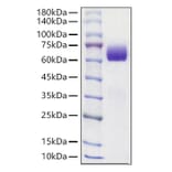 SDS-PAGE - Recombinant Mouse Axl Protein (C-terminal His Tag) (A331930) - Antibodies.com