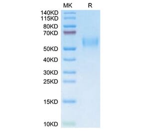 SDS-PAGE - Recombinant Mouse uPAR Protein (C-terminal His and Avi Tag) (A331931) - Antibodies.com