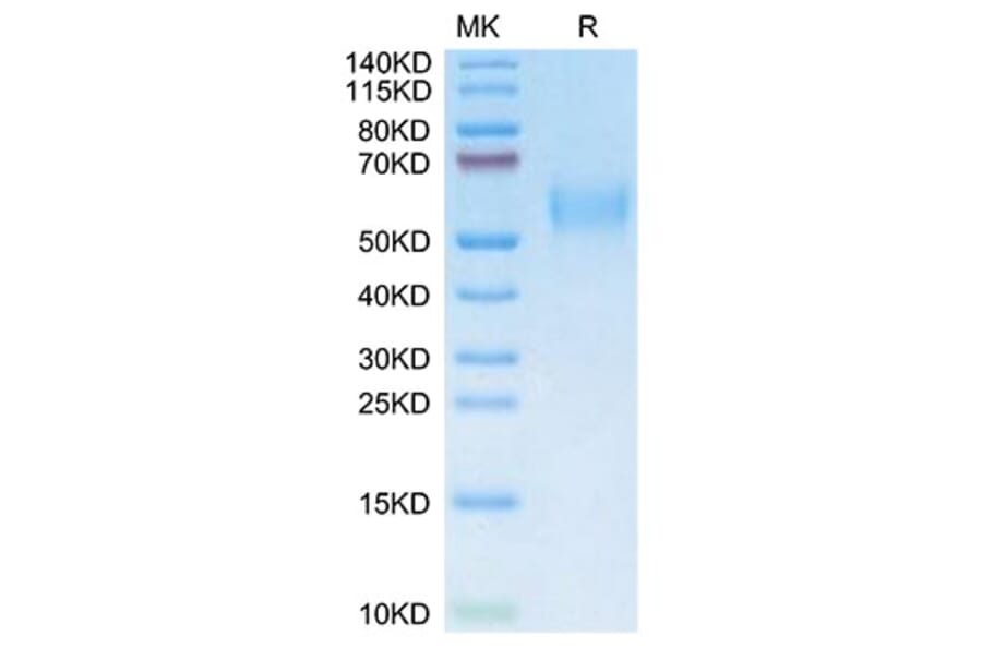 SDS-PAGE - Recombinant Mouse uPAR Protein (C-terminal His and Avi Tag) (A331931) - Antibodies.com