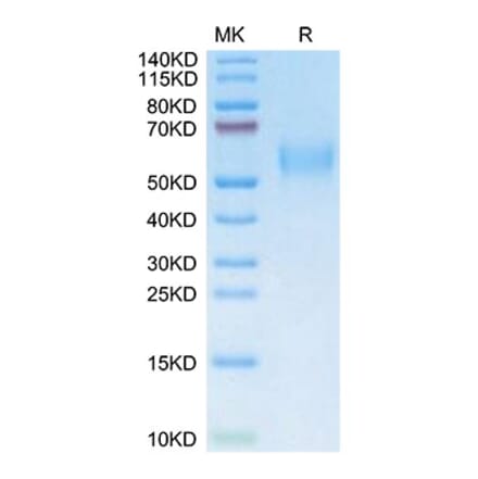 SDS-PAGE - Recombinant Mouse uPAR Protein (C-terminal His and Avi Tag) (A331931) - Antibodies.com