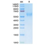 SDS-PAGE - Recombinant Mouse uPAR Protein (C-terminal His and Avi Tag) (A331931) - Antibodies.com