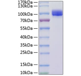 SDS-PAGE - Recombinant Mouse VCAM-1 Protein (C-terminal His Tag) (A331932) - Antibodies.com