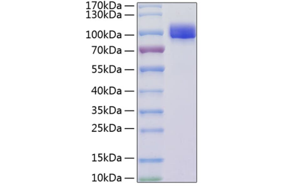 SDS-PAGE - Recombinant Mouse VCAM-1 Protein (C-terminal His Tag) (A331932) - Antibodies.com