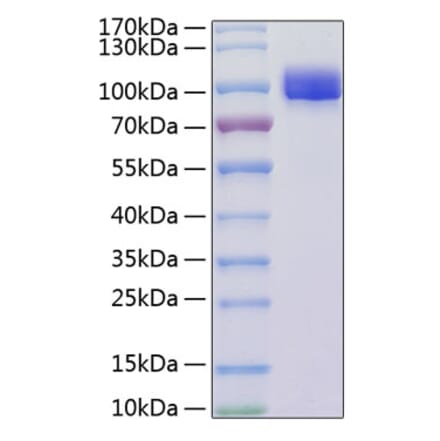 SDS-PAGE - Recombinant Mouse VCAM-1 Protein (C-terminal His Tag) (A331932) - Antibodies.com