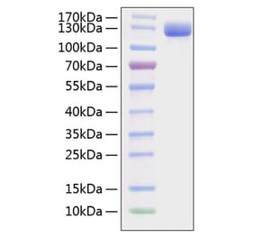 SDS-PAGE - Recombinant Mouse VCAM-1 Protein (C-terminal Human Fc and His Tag) (A331933) - Antibodies.com