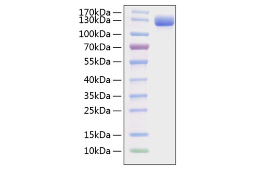 SDS-PAGE - Recombinant Mouse VCAM-1 Protein (C-terminal Human Fc and His Tag) (A331933) - Antibodies.com