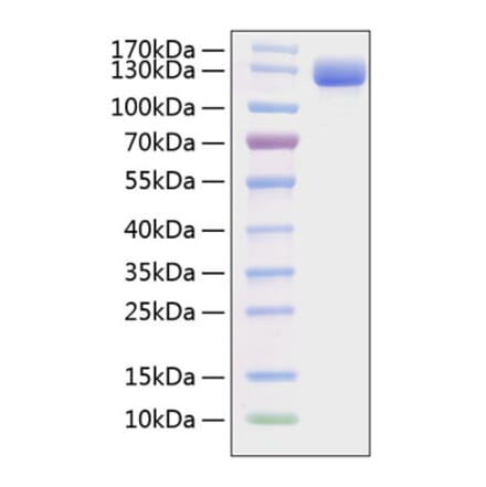 SDS-PAGE - Recombinant Mouse VCAM-1 Protein (C-terminal Human Fc and His Tag) (A331933) - Antibodies.com