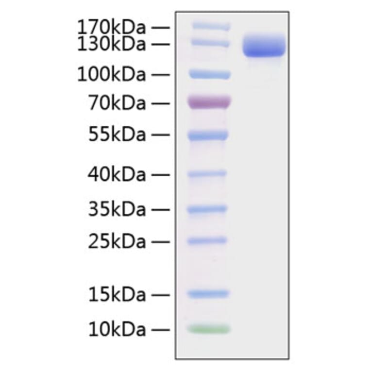 SDS-PAGE - Recombinant Mouse VCAM-1 Protein (C-terminal Human Fc and His Tag) (A331933) - Antibodies.com