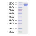 SDS-PAGE - Recombinant Mouse VCAM-1 Protein (C-terminal Human Fc and His Tag) (A331933) - Antibodies.com