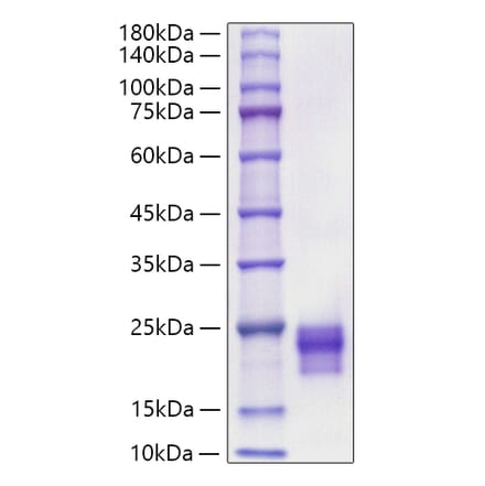 SDS-PAGE - Recombinant Mouse/Rat VEGF-C Protein (C-terminal His Tag) (A331936) - Antibodies.com