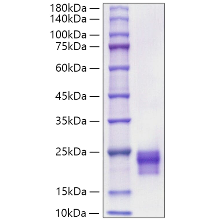 SDS-PAGE - Recombinant Mouse/Rat VEGF-C Protein (C-terminal His Tag) (A331936) - Antibodies.com