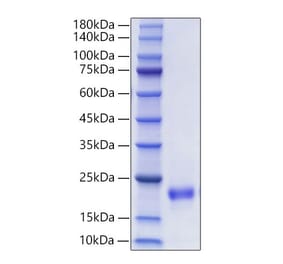 SDS-PAGE - Recombinant Mouse FIGF Protein (C-terminal His Tag) (A331937) - Antibodies.com