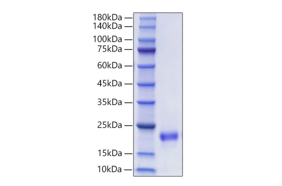 SDS-PAGE - Recombinant Mouse FIGF Protein (C-terminal His Tag) (A331937) - Antibodies.com