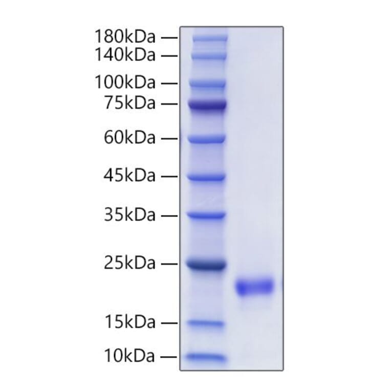 SDS-PAGE - Recombinant Mouse FIGF Protein (C-terminal His Tag) (A331937) - Antibodies.com