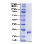 SDS-PAGE - Recombinant Mouse FIGF Protein (C-terminal His Tag) (A331937) - Antibodies.com