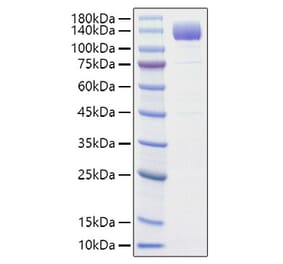 SDS-PAGE - Recombinant Rat VEGF Receptor 2 Protein (C-terminal His Tag) (A331938) - Antibodies.com