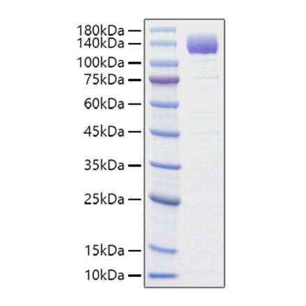 SDS-PAGE - Recombinant Rat VEGF Receptor 2 Protein (C-terminal His Tag) (A331938) - Antibodies.com