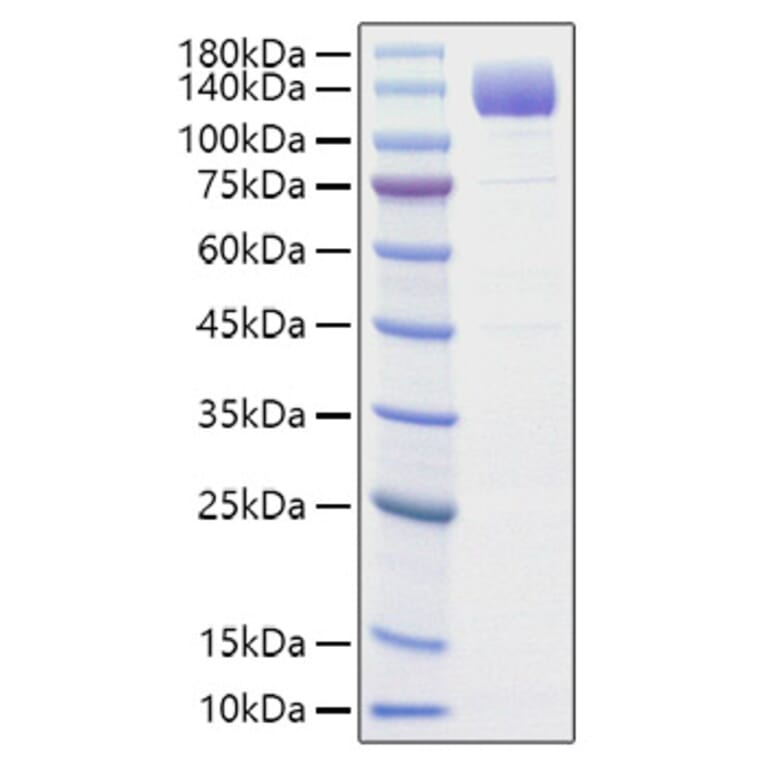 SDS-PAGE - Recombinant Rat VEGF Receptor 2 Protein (C-terminal His Tag) (A331938) - Antibodies.com