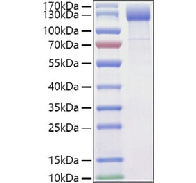 SDS-PAGE - Recombinant Mouse VEGF Receptor 2 Protein (C-terminal His Tag) (A331939) - Antibodies.com