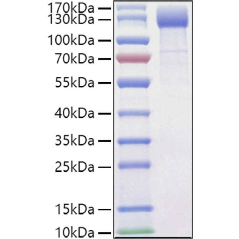 SDS-PAGE - Recombinant Mouse VEGF Receptor 2 Protein (C-terminal His Tag) (A331939) - Antibodies.com