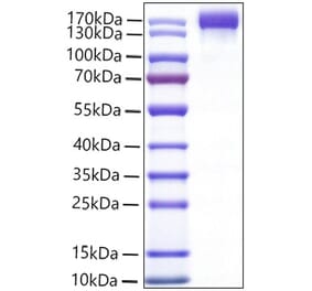 SDS-PAGE - Recombinant Mouse VEGF Receptor 2 Protein (C-terminal Human Fc Tag) (A331940) - Antibodies.com