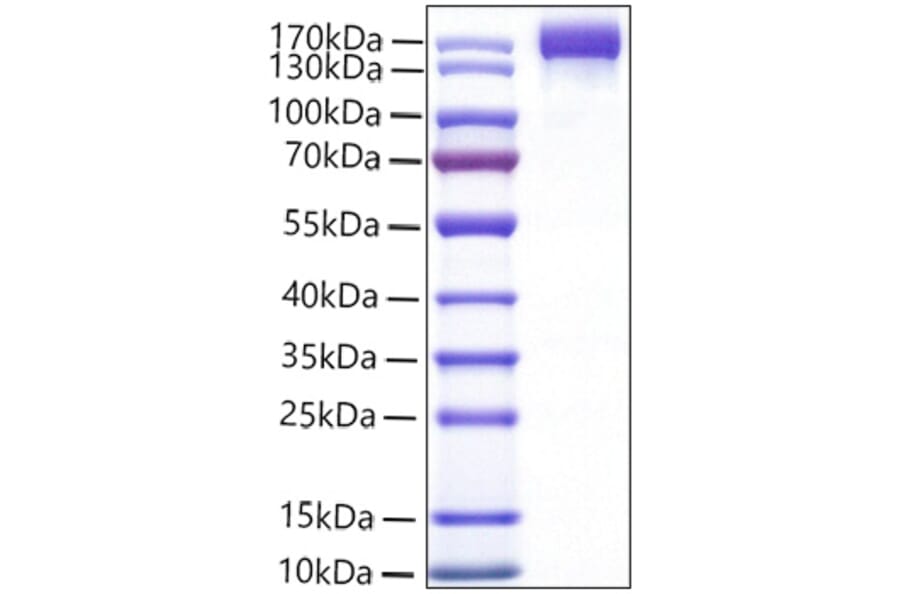 SDS-PAGE - Recombinant Mouse VEGF Receptor 2 Protein (C-terminal Human Fc Tag) (A331940) - Antibodies.com