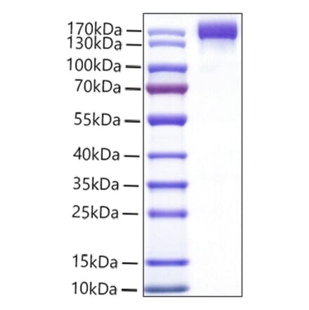 SDS-PAGE - Recombinant Mouse VEGF Receptor 2 Protein (C-terminal Human Fc Tag) (A331940) - Antibodies.com