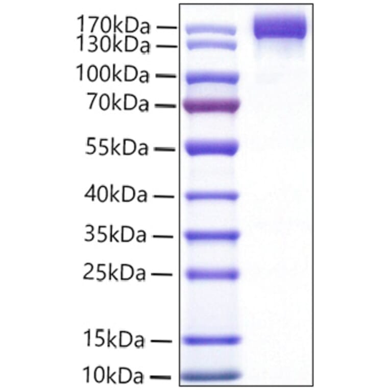 SDS-PAGE - Recombinant Mouse VEGF Receptor 2 Protein (C-terminal Human Fc Tag) (A331940) - Antibodies.com